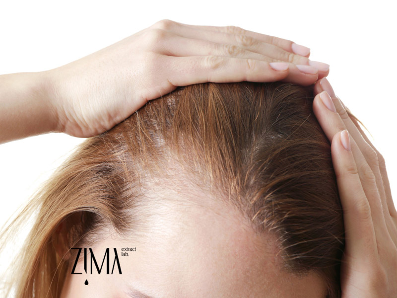 درمان بیماری مو با روغن سیاهدانه